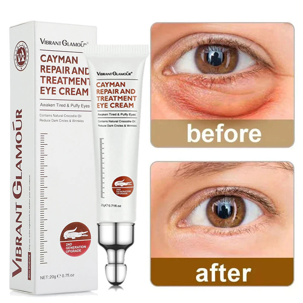 Anti-Aging Eye Cream